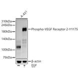 Western Blot - Anti-VEGF Receptor 2 (phospho Tyr1175) Antibody [ARC57293] (A309514) - Antibodies.com