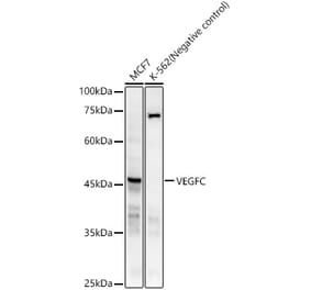 Western Blot - Anti-VEGFC Antibody [ARC59857] (A309515) - Antibodies.com