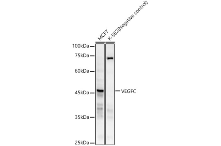 Western Blot - Anti-VEGFC Antibody [ARC59857] (A309515) - Antibodies.com