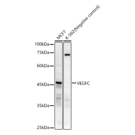 Western Blot - Anti-VEGFC Antibody [ARC59857] (A309515) - Antibodies.com