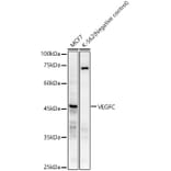 Western Blot - Anti-VEGFC Antibody [ARC59857] (A309515) - Antibodies.com