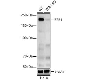 Western Blot - Anti-ZEB1 Antibody (A309518) - Antibodies.com