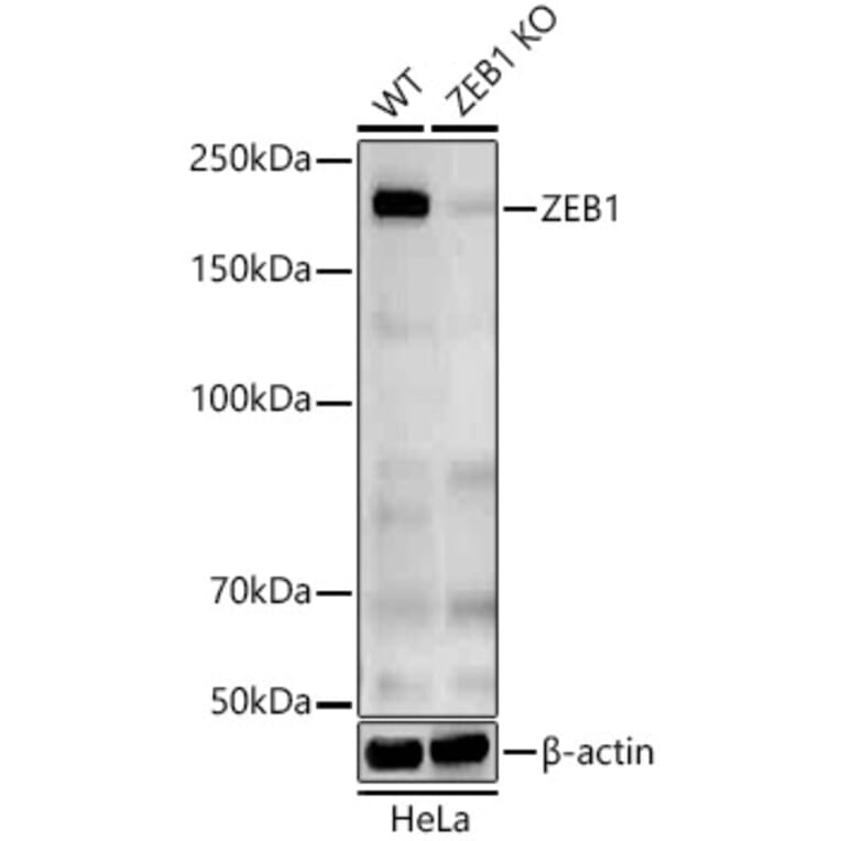 Western Blot - Anti-ZEB1 Antibody (A309518) - Antibodies.com