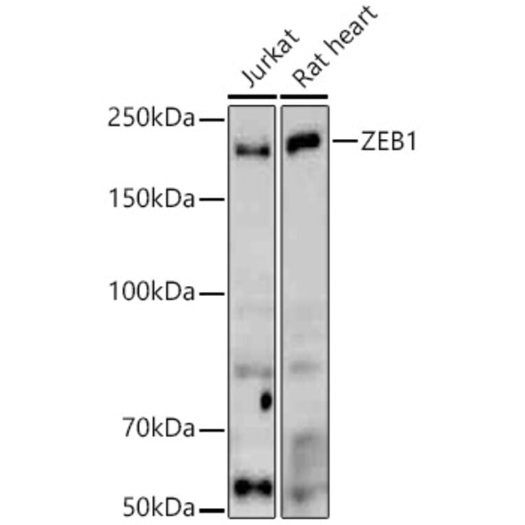 Western Blot - Anti-ZEB1 Antibody (A309518) - Antibodies.com