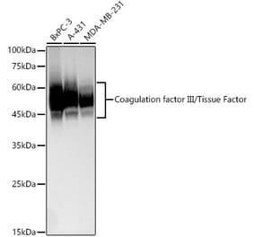 Western Blot - Anti-Tissue Factor Antibody [ARC60559] (A309523) - Antibodies.com