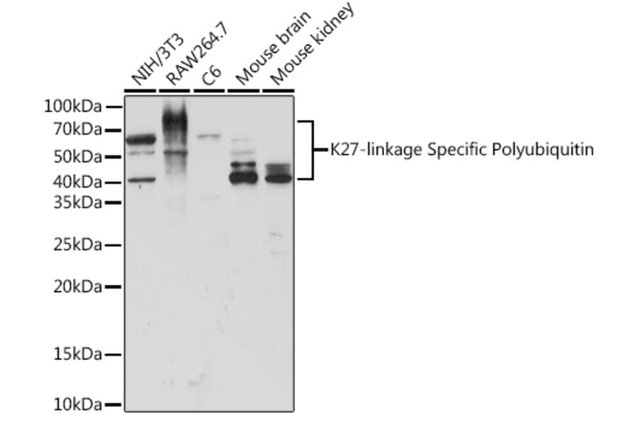 Western Blot - Anti-K27-linkage specific Polyubiquitin Antibody (A309527) - Antibodies.com