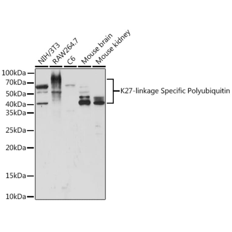 Western Blot - Anti-K27-linkage specific Polyubiquitin Antibody (A309527) - Antibodies.com