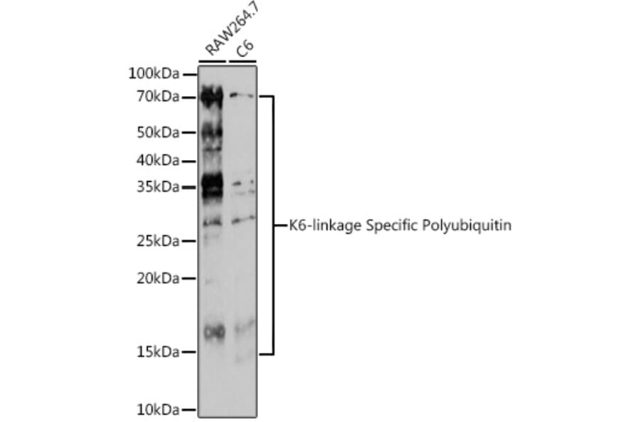 Western Blot - Anti-K6-linkage specific Polyubiquitin Antibody (A309533) - Antibodies.com