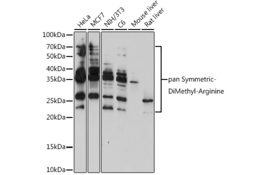Western Blot - Anti-pan symmetric di-methyl Arginine Antibody (A309535) - Antibodies.com