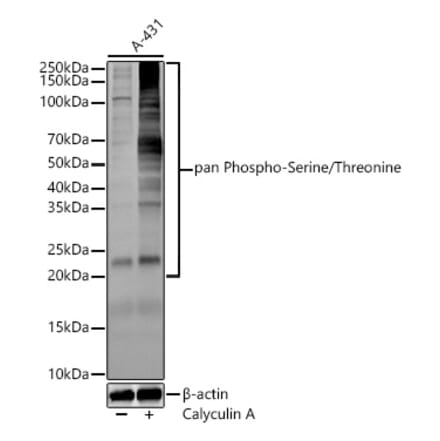Western Blot - Anti-Pan Phospho-Serine/Threonine Antibody (A309541) - Antibodies.com
