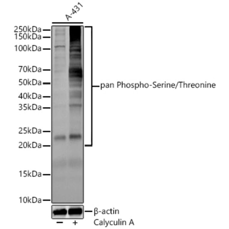 Western Blot - Anti-Pan Phospho-Serine/Threonine Antibody (A309541) - Antibodies.com