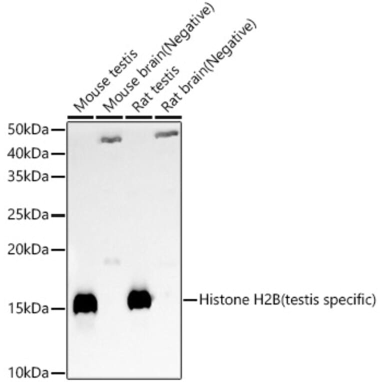 Western Blot - Anti-Histone H2B (testis specific) Antibody (A309542) - Antibodies.com