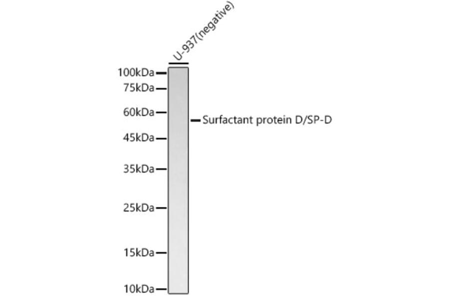 Western Blot - Anti-Surfactant protein D/SP-D Antibody [ARC57711] (A309549) - Antibodies.com