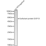 Western Blot - Anti-Surfactant protein D/SP-D Antibody [ARC57711] (A309549) - Antibodies.com