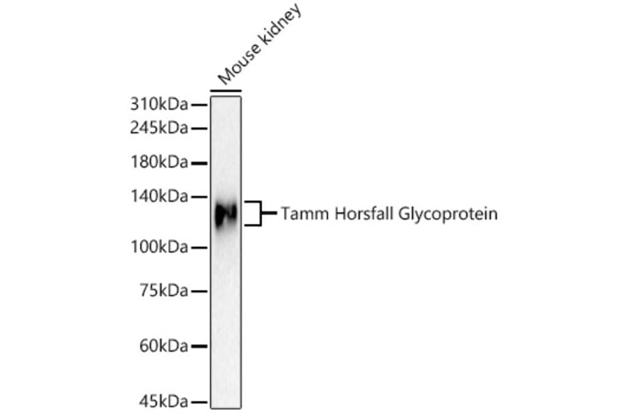 Western Blot - Anti-UMOD Antibody (A309550) - Antibodies.com