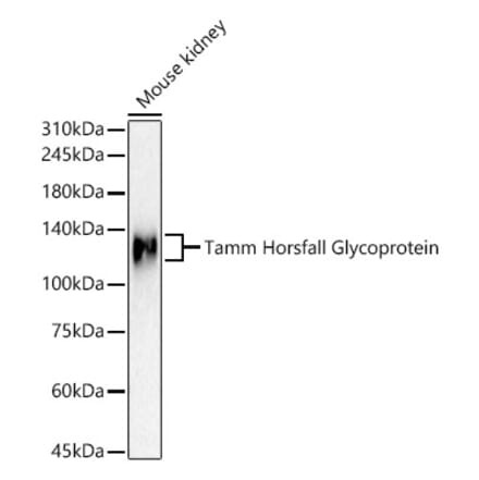Western Blot - Anti-UMOD Antibody (A309550) - Antibodies.com