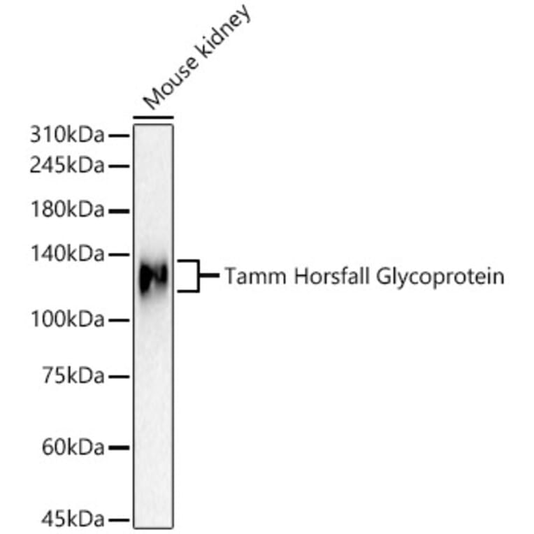Western Blot - Anti-UMOD Antibody (A309550) - Antibodies.com