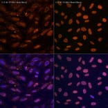 Immunofluorescence - Anti-N6-methyladenosine / m6A Antibody [ARC5003-10] (A309557) - Antibodies.com