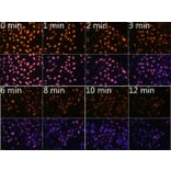Immunofluorescence - Anti-N6-methyladenosine/m6A Antibody [ARC5003-03] (A309558) - Antibodies.com
