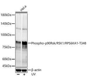 Western Blot - Anti-RSK1 p90 (phospho Thr348) Antibody (A309559) - Antibodies.com
