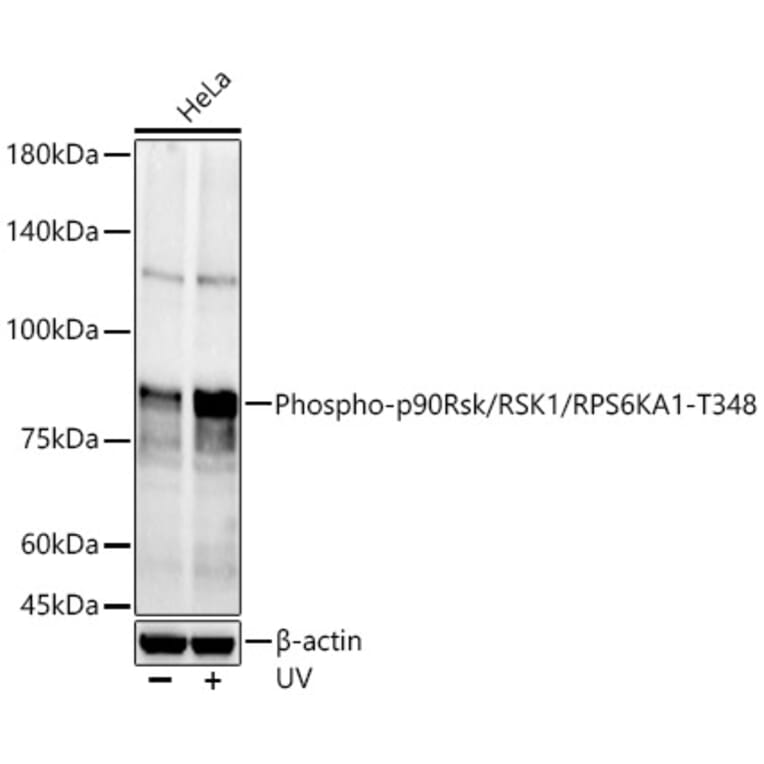 Western Blot - Anti-RSK1 p90 (phospho Thr348) Antibody (A309559) - Antibodies.com