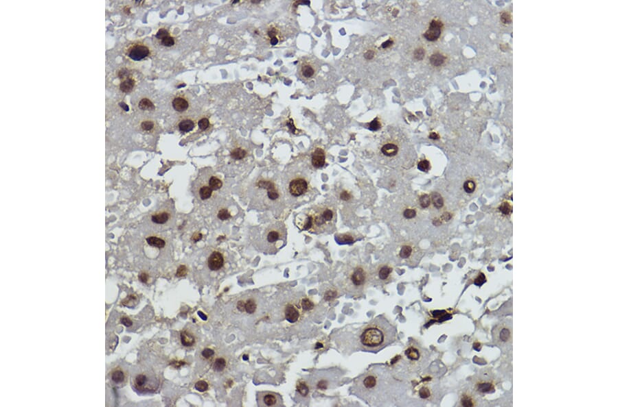 Immunohistochemistry - Anti-Histone H2B (formyl K108) Antibody [ARC2492] (A309561) - Antibodies.com
