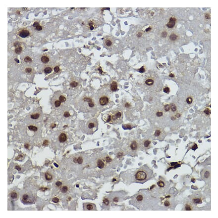 Immunohistochemistry - Anti-Histone H2B (formyl K108) Antibody [ARC2492] (A309561) - Antibodies.com
