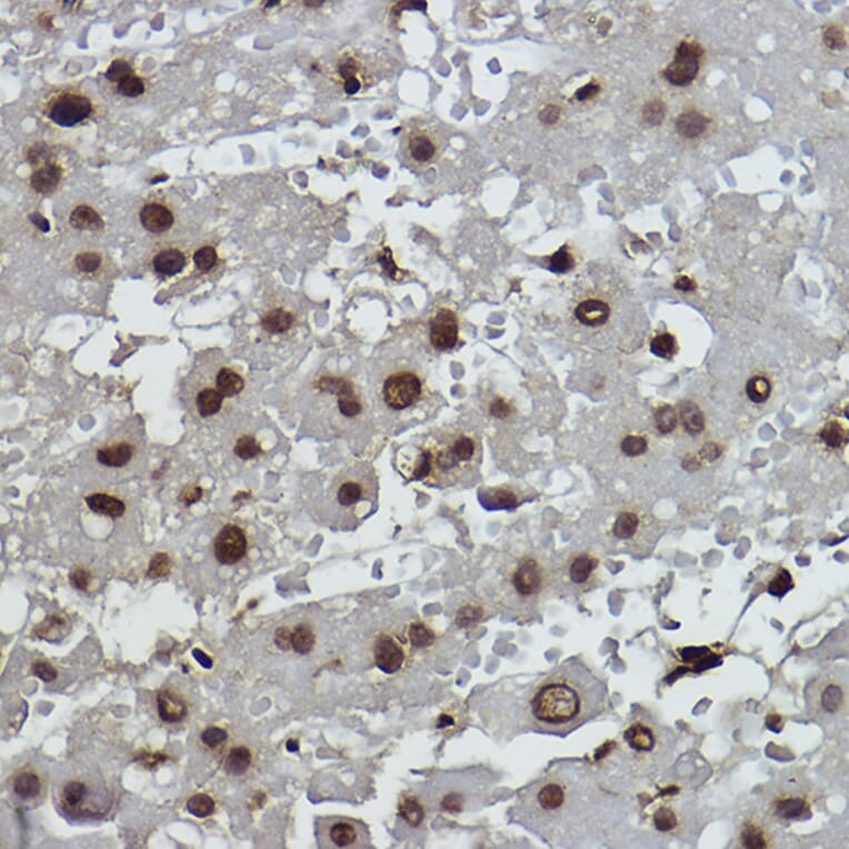 Immunohistochemistry - Anti-Histone H2B (formyl K108) Antibody [ARC2492] (A309561) - Antibodies.com