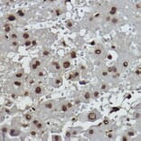 Immunohistochemistry - Anti-Histone H2B (formyl K108) Antibody [ARC2492] (A309561) - Antibodies.com