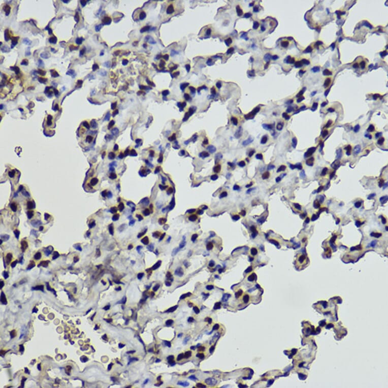 Immunohistochemistry - Anti-Histone H2B (formyl K108) Antibody [ARC2492] (A309561) - Antibodies.com
