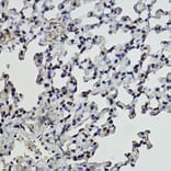 Immunohistochemistry - Anti-Histone H2B (formyl K108) Antibody [ARC2492] (A309561) - Antibodies.com