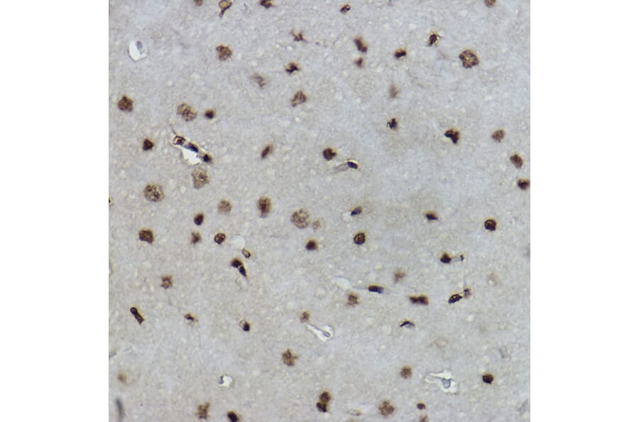 Immunohistochemistry - Anti-Histone H2B (formyl K108) Antibody [ARC2492] (A309561) - Antibodies.com