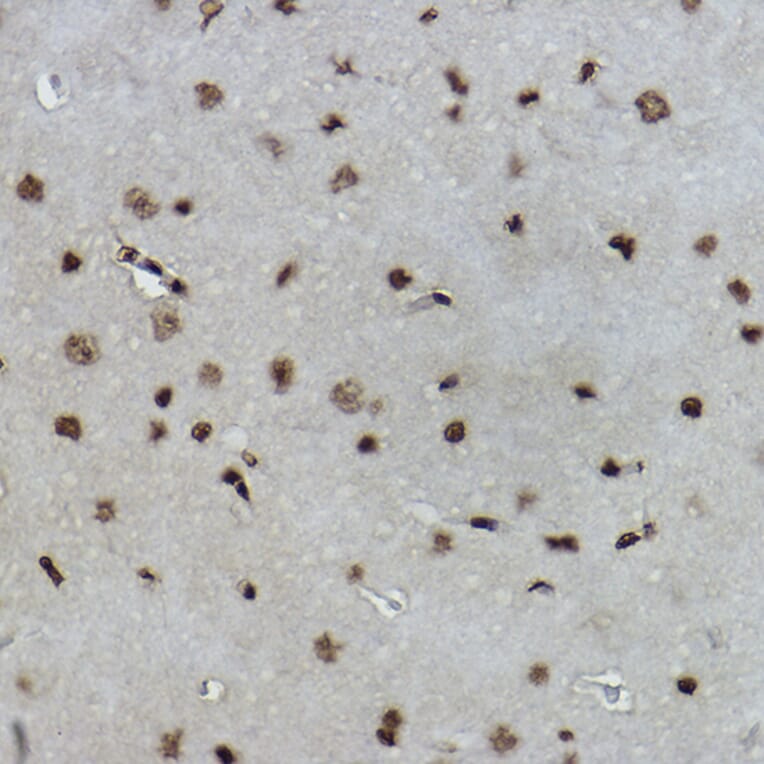 Immunohistochemistry - Anti-Histone H2B (formyl K108) Antibody [ARC2492] (A309561) - Antibodies.com