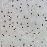 Immunohistochemistry - Anti-Histone H2B (formyl K108) Antibody [ARC2492] (A309561) - Antibodies.com