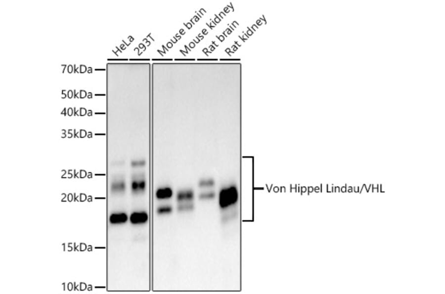 Western Blot - Anti-Von Hippel Lindau/VHL Antibody [ARC59984] (A309563) - Antibodies.com