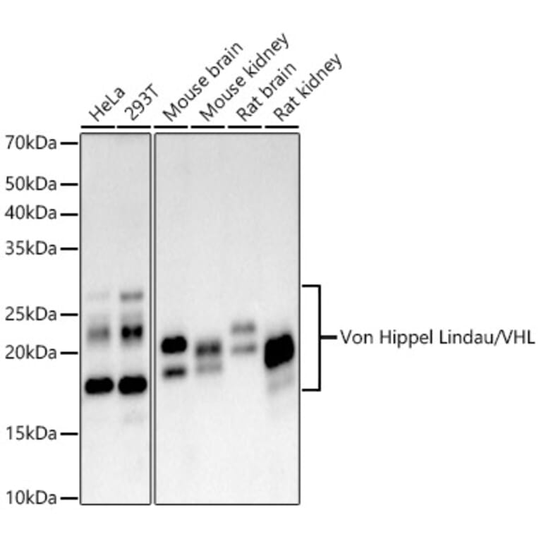 Western Blot - Anti-Von Hippel Lindau/VHL Antibody [ARC59984] (A309563) - Antibodies.com