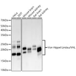 Western Blot - Anti-Von Hippel Lindau/VHL Antibody [ARC59984] (A309563) - Antibodies.com
