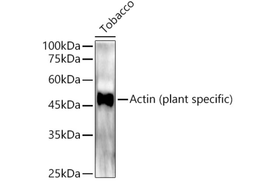 Western Blot - Anti-Actin (phospho lant-specific) Antibody (A309564) - Antibodies.com