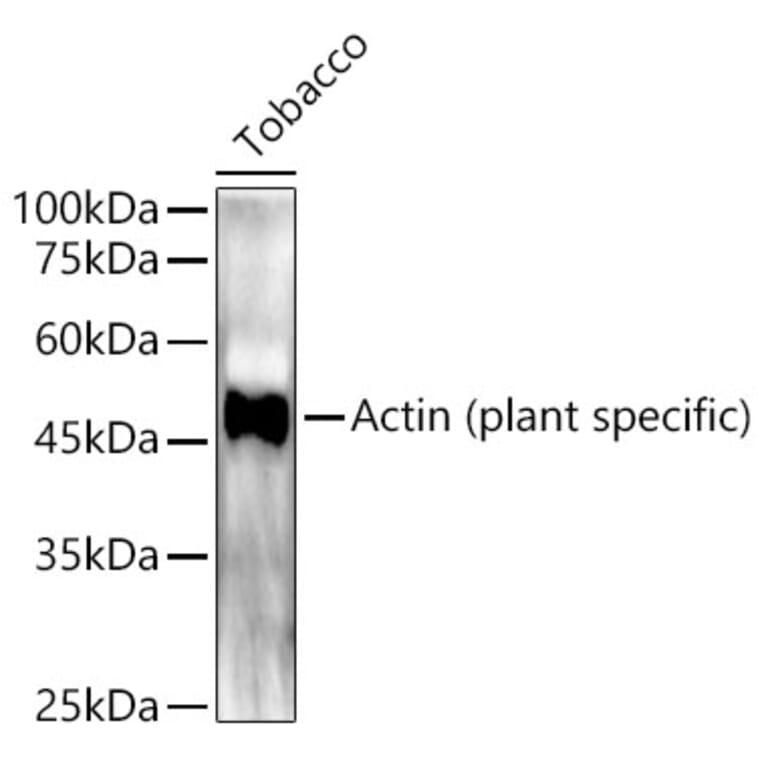 Western Blot - Anti-Actin (phospho lant-specific) Antibody (A309564) - Antibodies.com