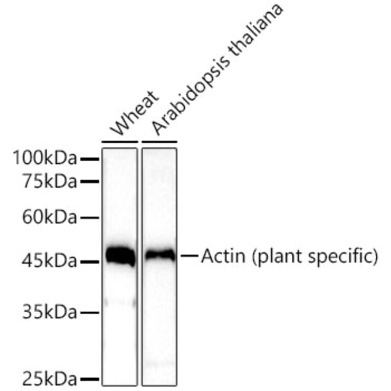 Western Blot - Anti-Actin (phospho lant-specific) Antibody (A309564) - Antibodies.com