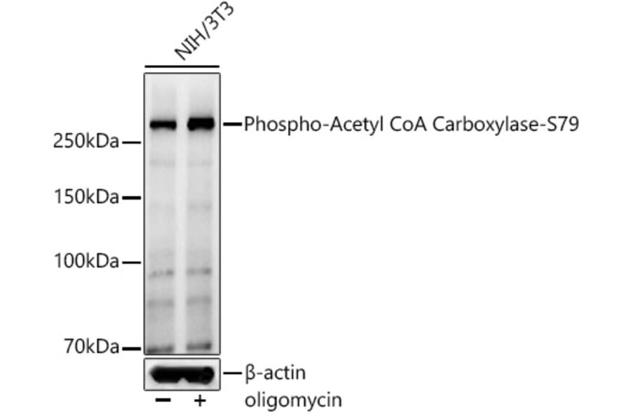 Western Blot - Anti-Acetyl Coenzyme A carboxylase (phospho Ser79) Antibody (A309565) - Antibodies.com