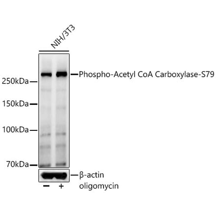 Western Blot - Anti-Acetyl Coenzyme A carboxylase (phospho Ser79) Antibody (A309565) - Antibodies.com