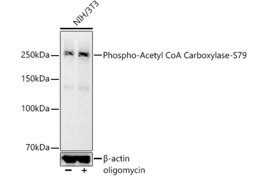 Western Blot - Anti-Acetyl Coenzyme A carboxylase (phospho Ser79) Antibody [ARC56611] (A309566) - Antibodies.com