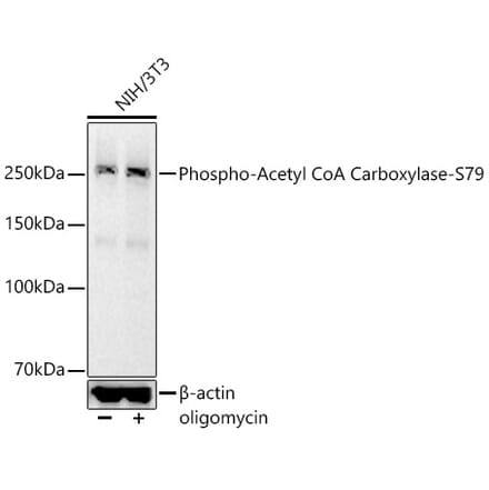 Western Blot - Anti-Acetyl Coenzyme A carboxylase (phospho Ser79) Antibody [ARC56611] (A309566) - Antibodies.com