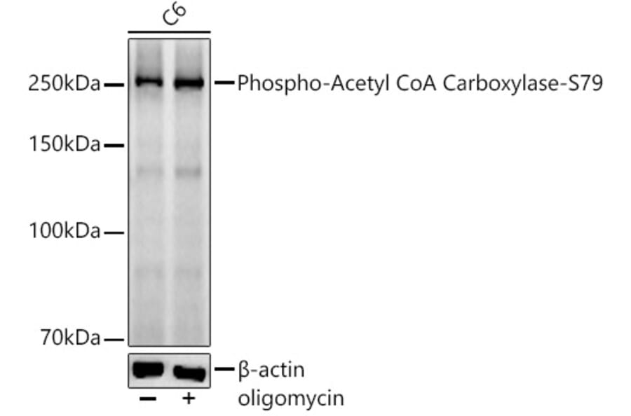 Western Blot - Anti-Acetyl Coenzyme A carboxylase (phospho Ser79) Antibody [ARC56611] (A309566) - Antibodies.com