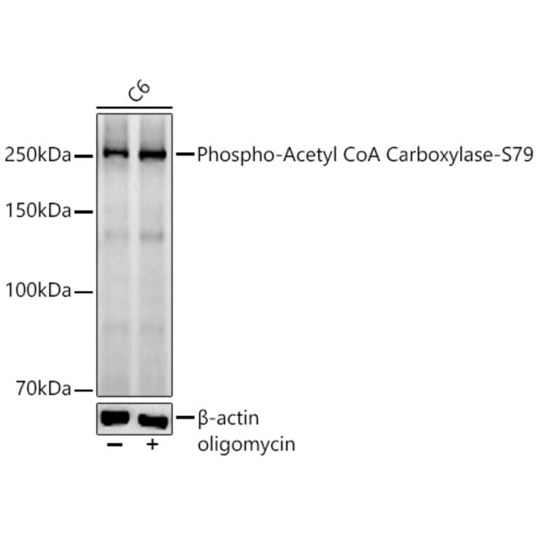 Western Blot - Anti-Acetyl Coenzyme A carboxylase (phospho Ser79) Antibody [ARC56611] (A309566) - Antibodies.com