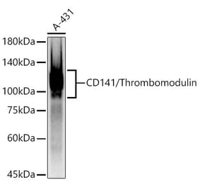 Western Blot - Anti-Thrombomodulin Antibody [ARC52599 + ARC52600] (A309567) - Antibodies.com