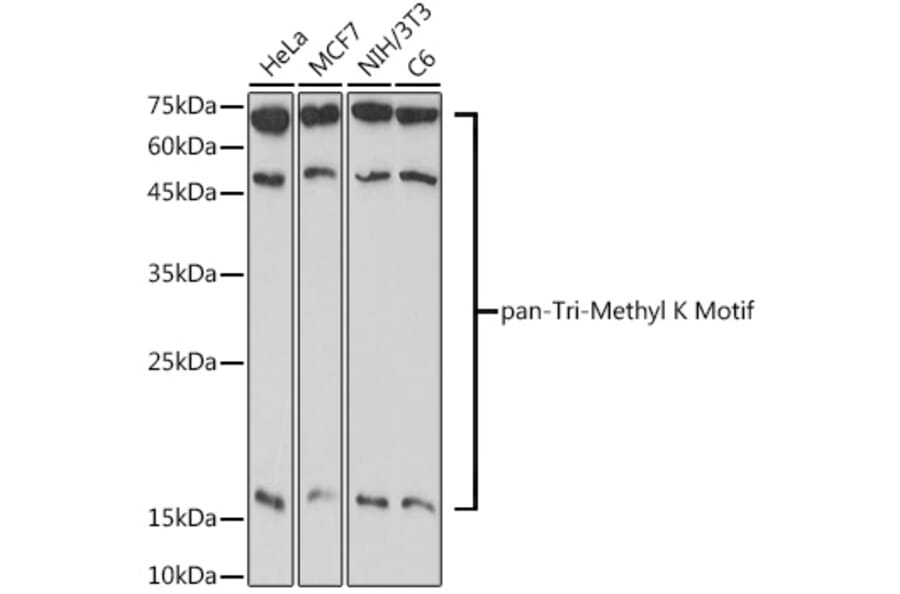 Western Blot - Anti-pan-tri-methyl Lysine Antibody (A309579) - Antibodies.com