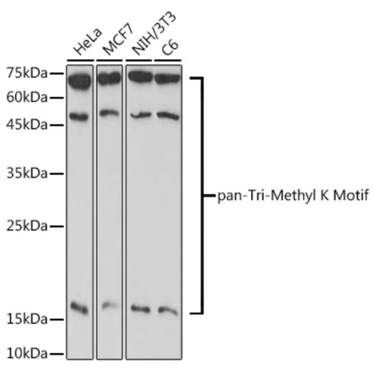 Western Blot - Anti-pan-tri-methyl Lysine Antibody (A309579) - Antibodies.com