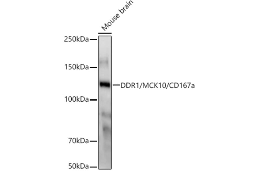 Western Blot - Anti-MCK10/NEP Antibody [ARC58637] (A309580) - Antibodies.com